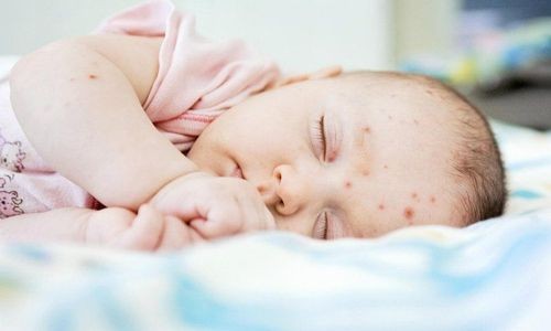 Trẻ 5 tháng tuổi bị nhiễm trùng có ảnh hưởng sau này không?