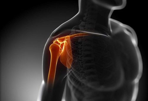 Người cao tuổi bị viêm, rách chóp xoay vai gây đau đớn