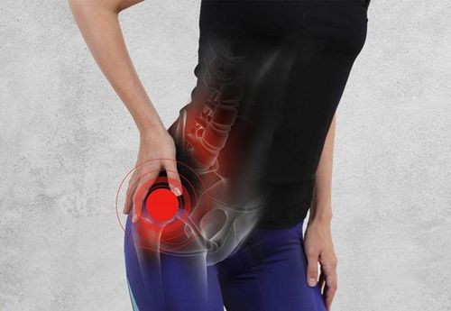 Lưu ý khi dùng thuốc chữa đau thần kinh tọa
