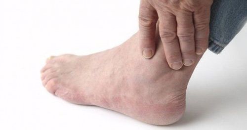 Các thuốc trị Gout phổ biến thường dùng